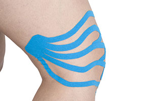 Lymftaping Lymftaping is een behandeling die kan worden toegepast bij oedeemtherapie